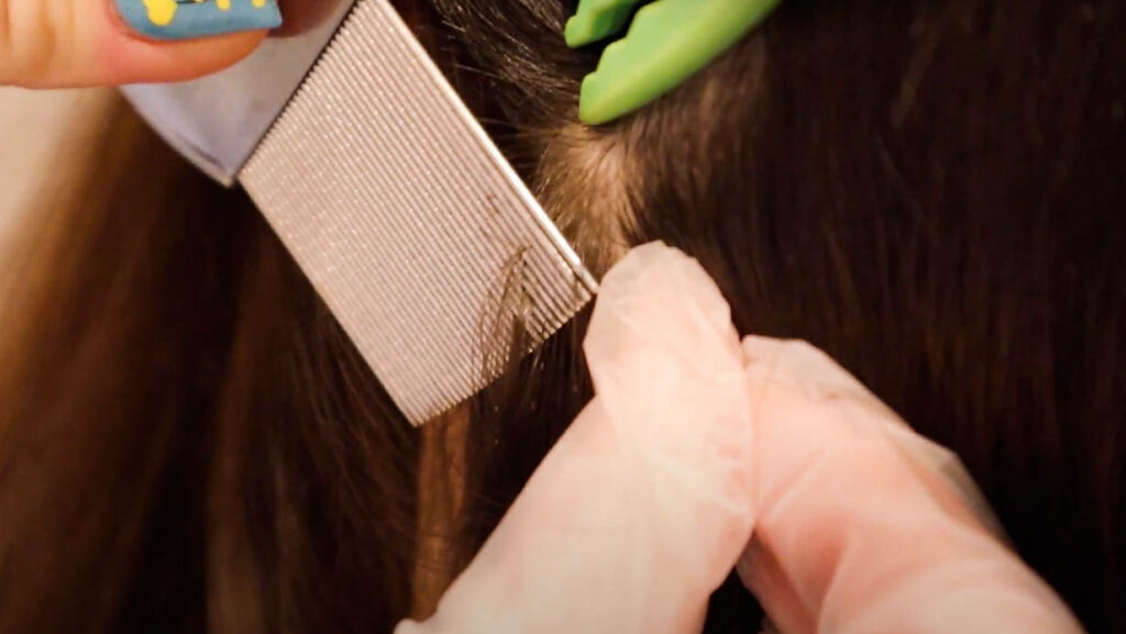 combing hair for lice